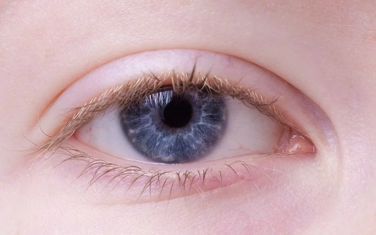 Krótkowidz, dalekowidz bądź też astygmatyk – diagnostyka u okulisty